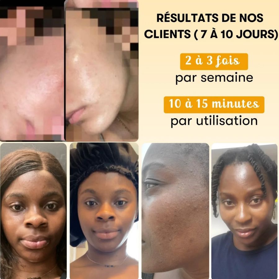 KURKUMA | Masque Anti-Imperfections au Curcuma